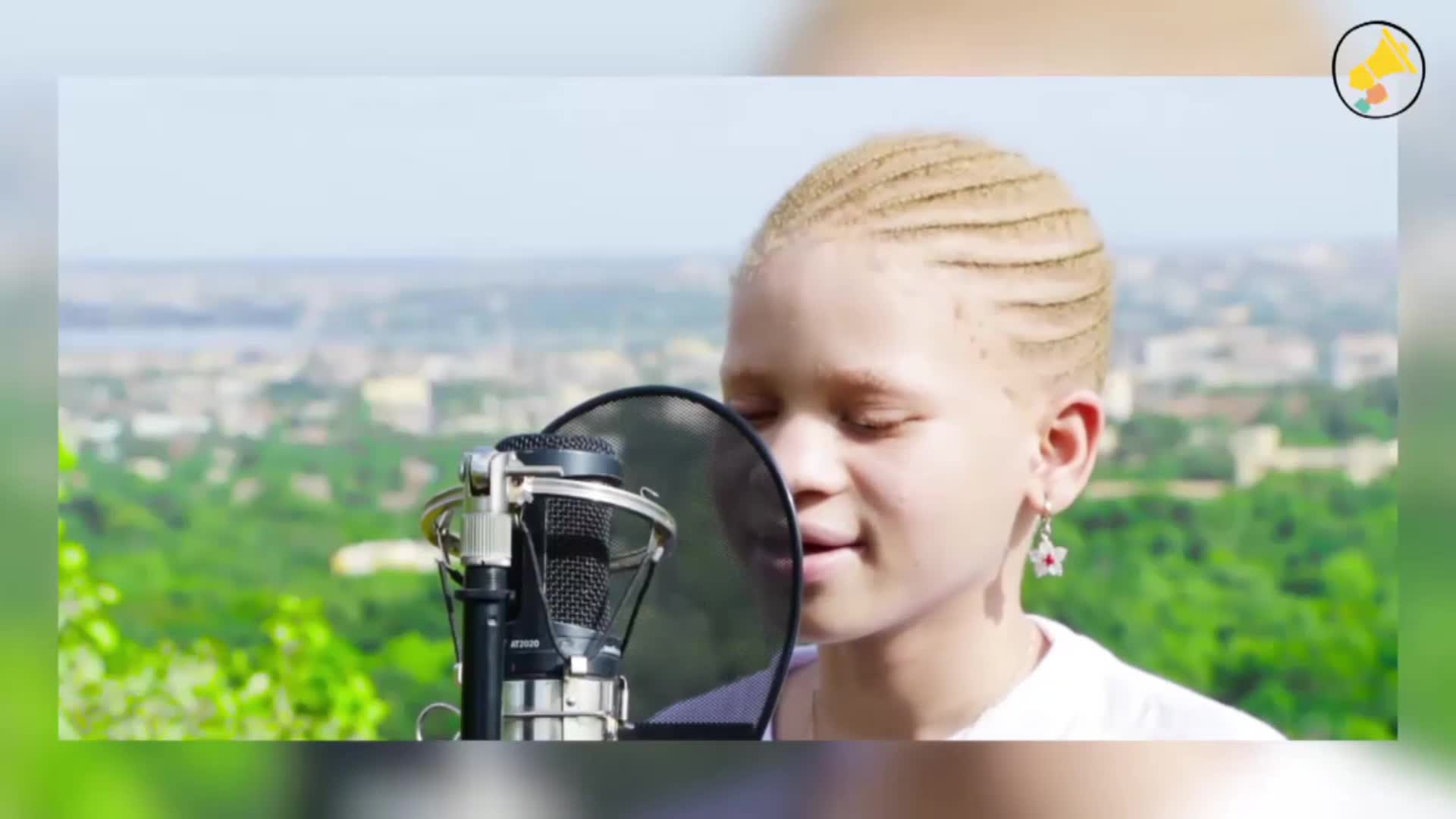 Mali : les jeunes albinos dénoncent la persécution
